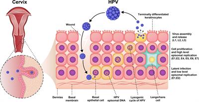 a helminthiasis betegség megelőzése csók okozta hpv vírus